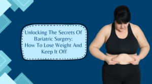 Unlocking The Secrets Of Bariatric Surgery How To Lose Weight And Keep It Off