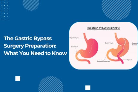 The Gastric Bypass Surgery Preparation: What You Need to Know