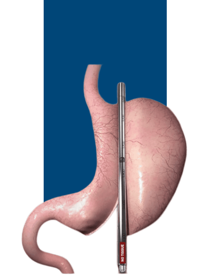 Weight Loss Surgery Dubai, Weight Loss or Bariatric Center Dubai