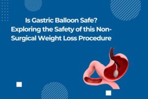 Is Gastric Balloon Safe? Exploring the Safety of this Non-Surgical Weight Loss Procedure
